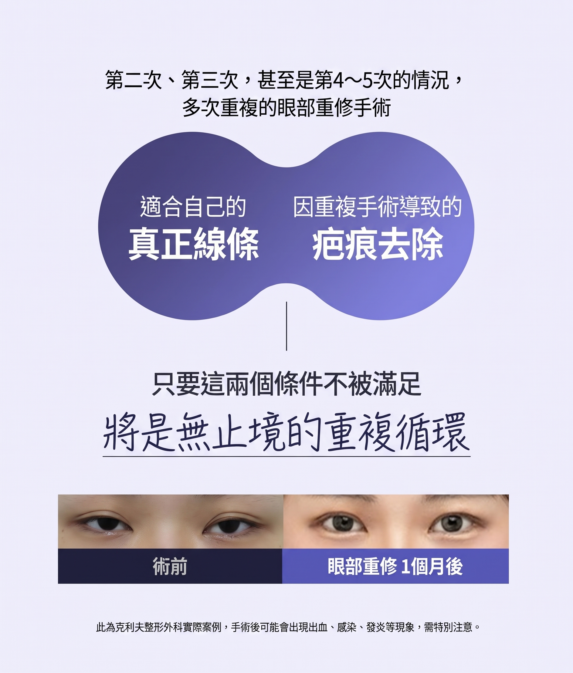 論峴站整形外科眼睛重修手術，哪些情況需要重修以及如何進行？ 사진 5
