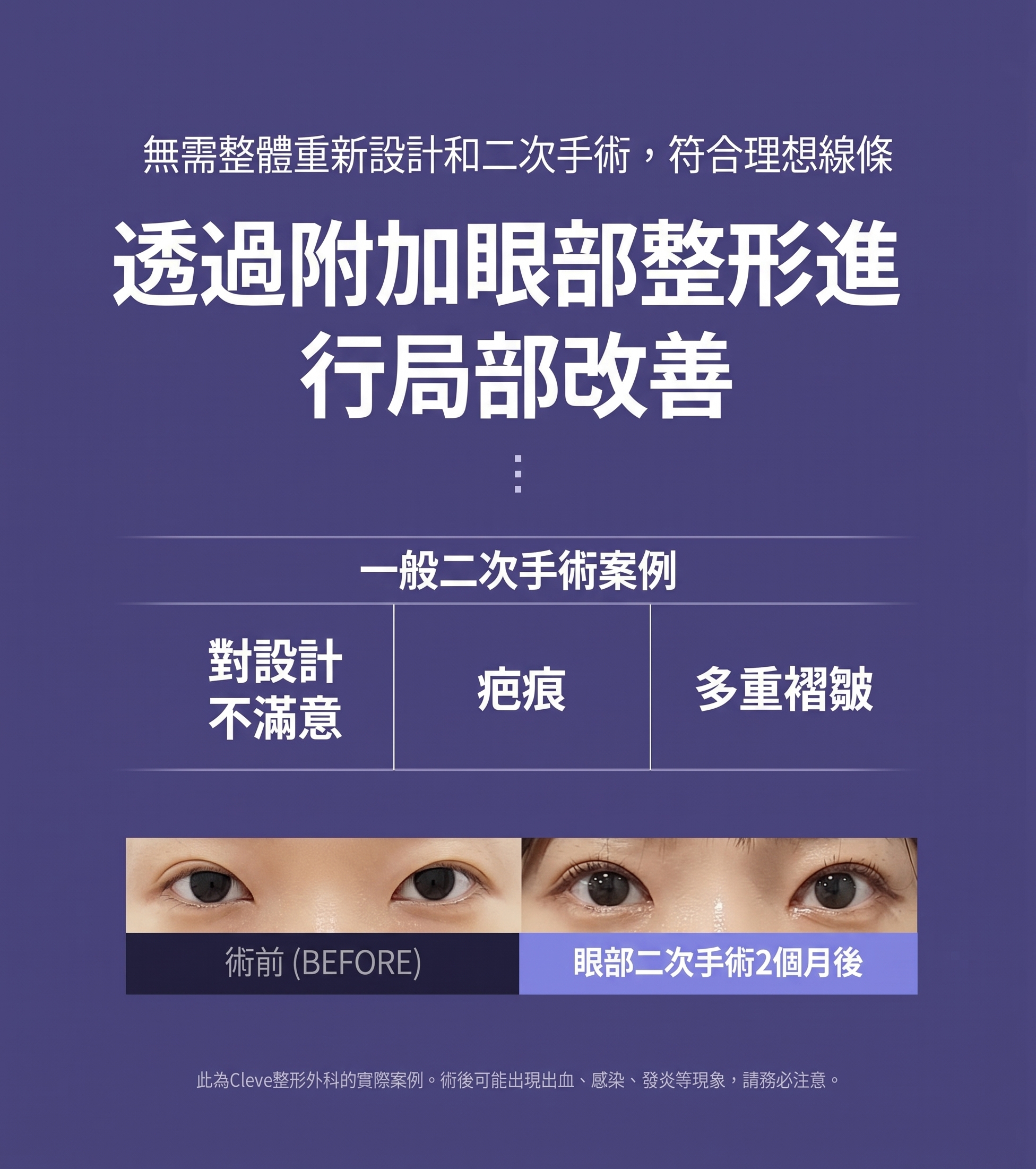 論峴站整形外科眼睛重修手術，哪些情況需要重修以及如何進行？ 사진 4