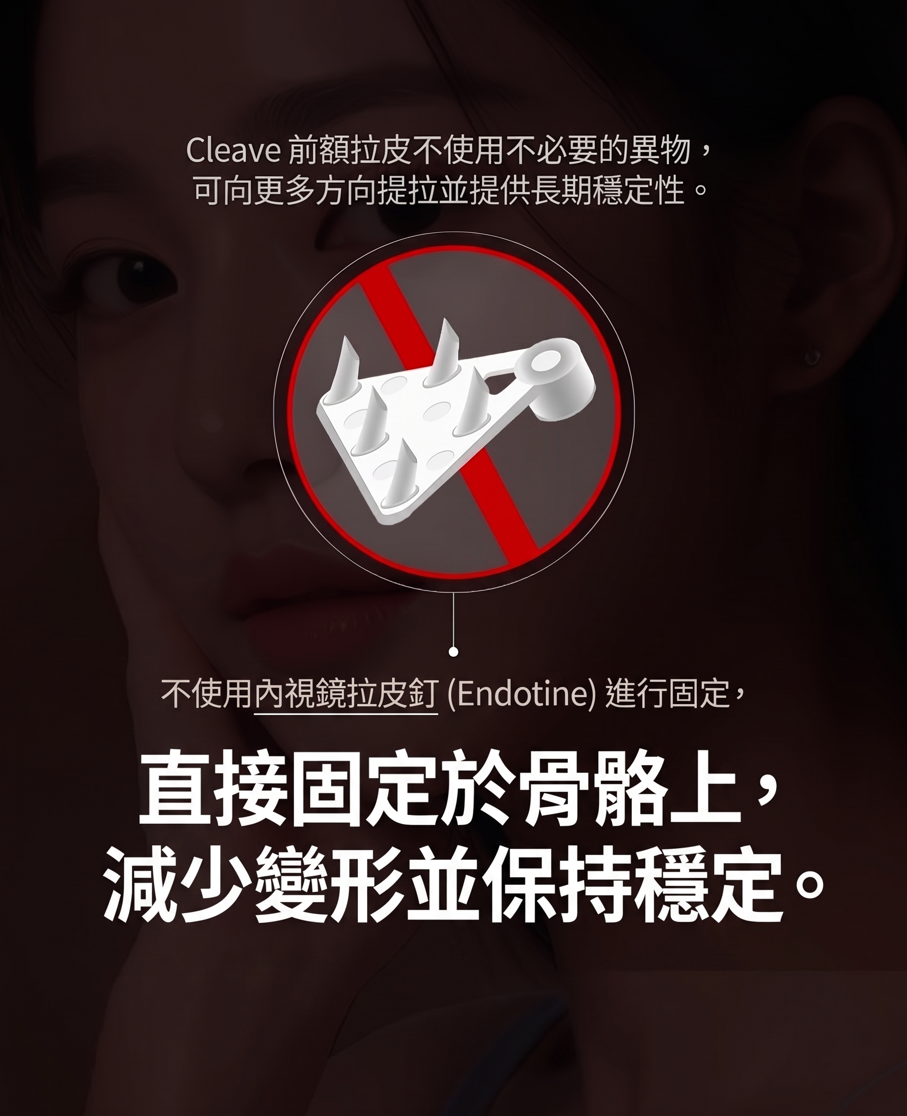 狎鷗亭整形外科額頭拉皮手術，如何避免一年後再次下垂？ 사진 8