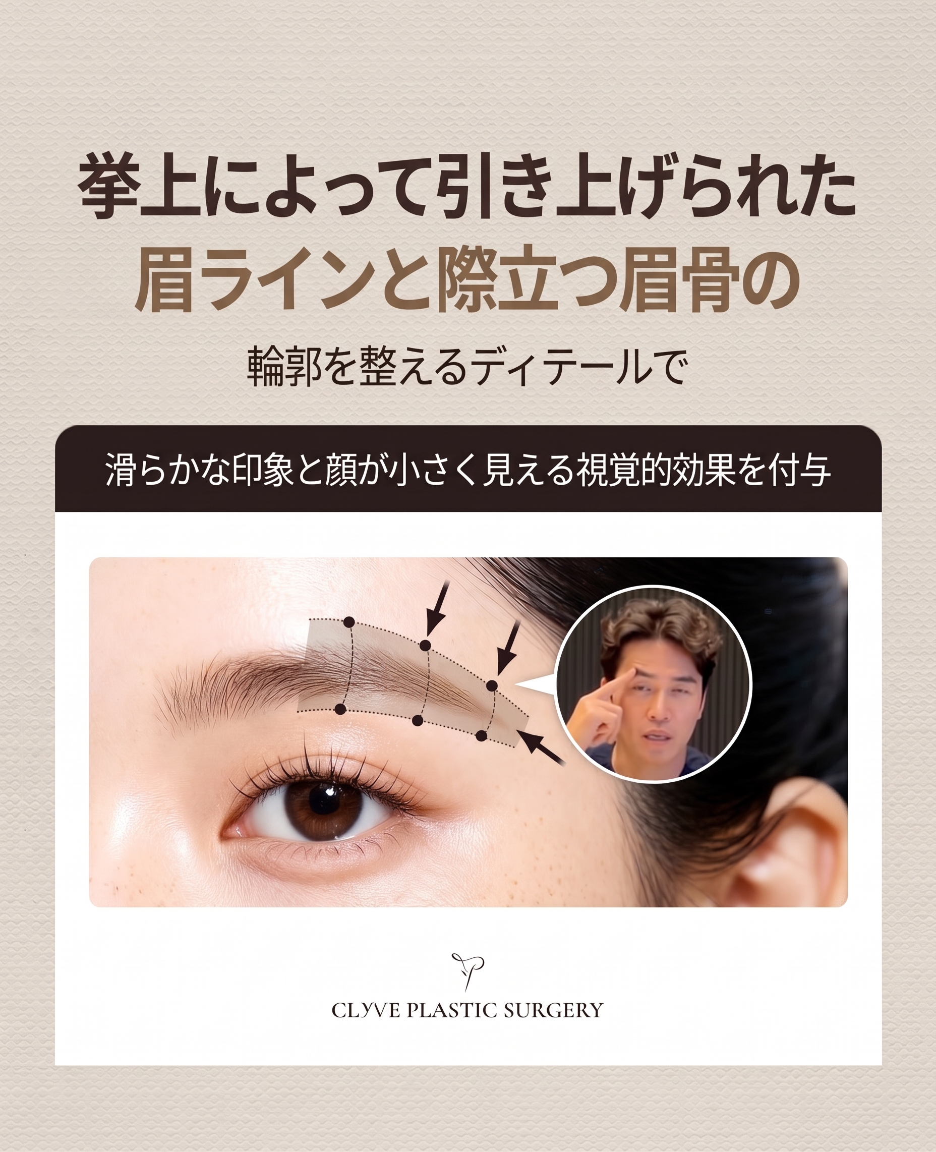 狎鴎亭洞美容外科の額リフト手術、1年で再びたるまないようにするには？ 사진 9