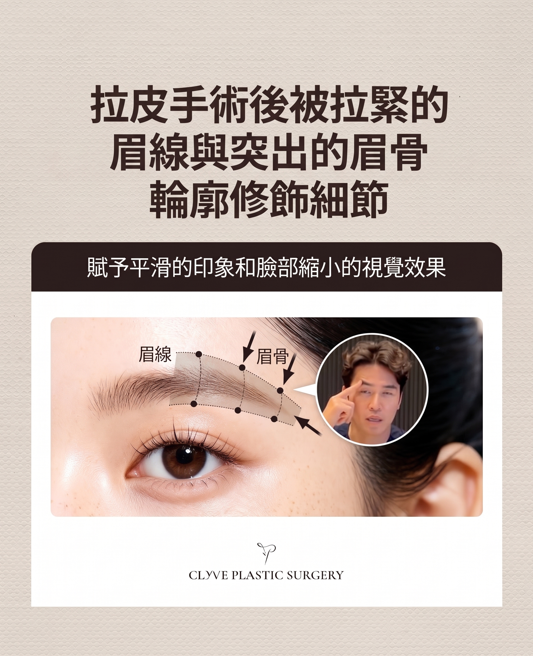 狎鷗亭整形外科額頭拉皮手術，如何避免一年後再次下垂？ 사진 9