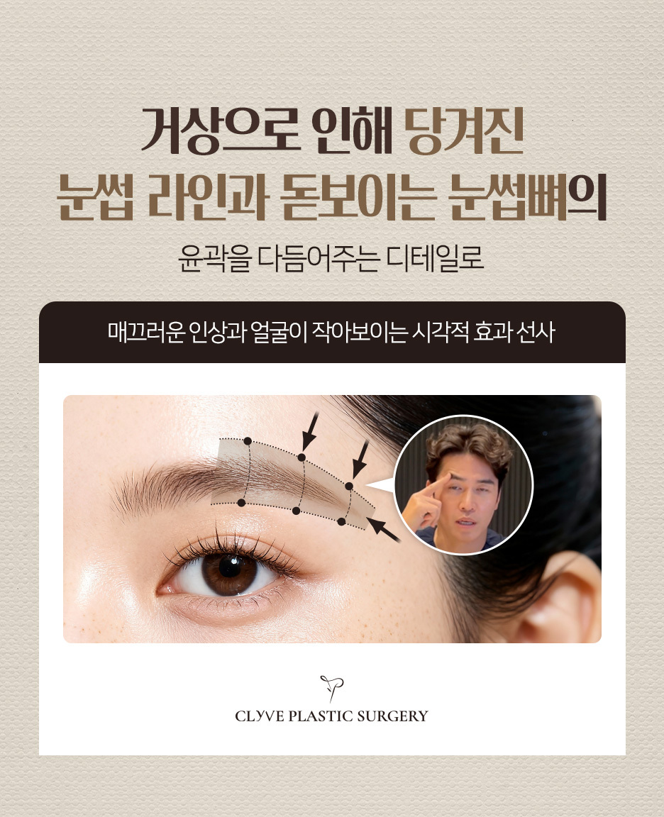압구정동성형외과 이마거상수술, 1년만에 다시 처지지 않으려면 어떻게 해야 할까요? 사진 9