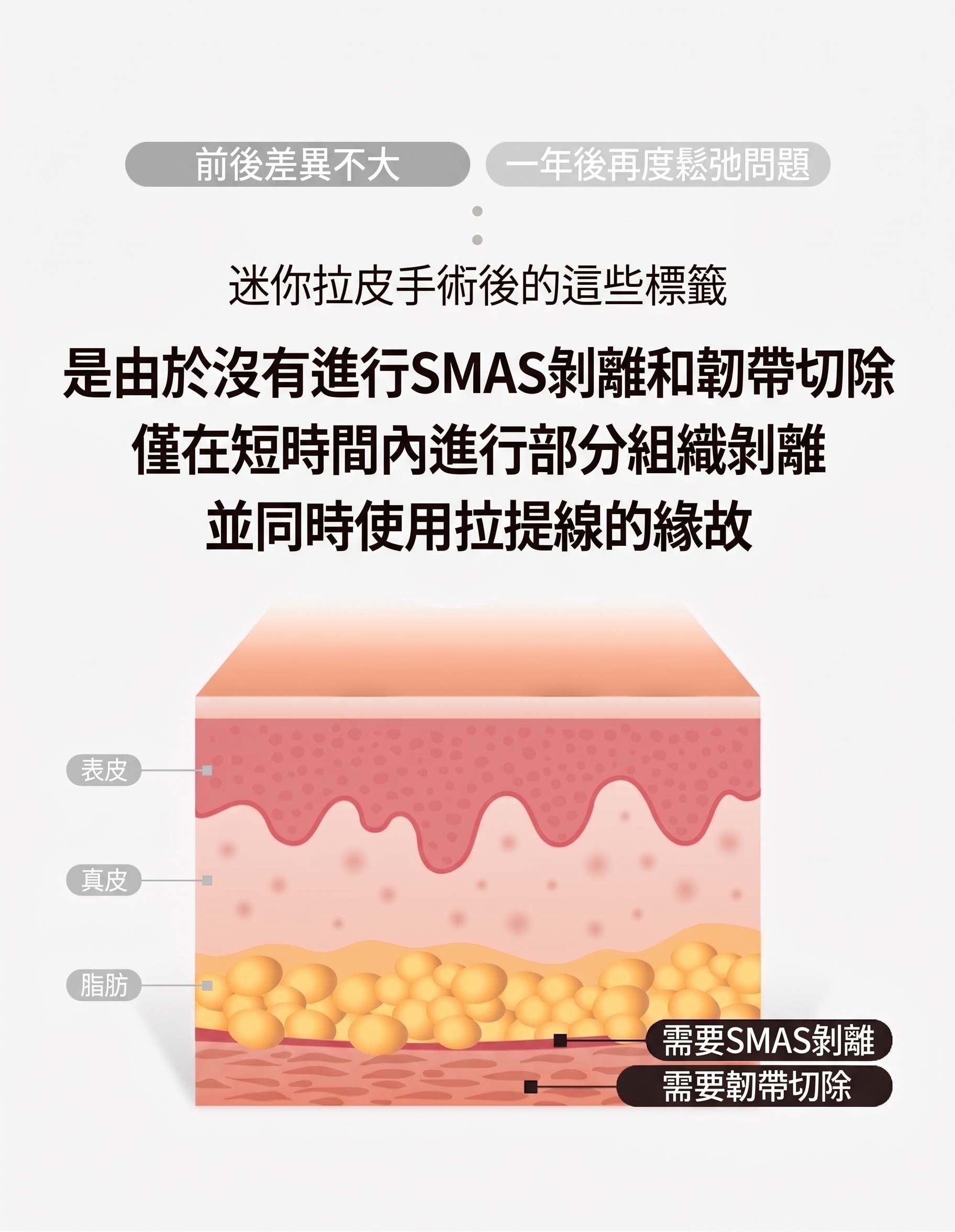狎鷗亭整形外科額頭拉皮手術，如何避免一年後再次下垂？ 사진 5