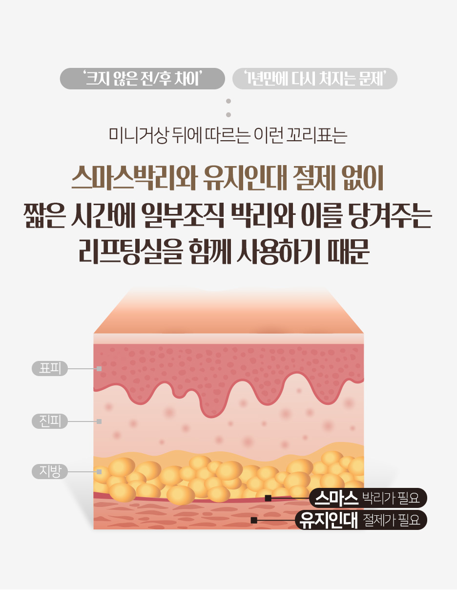 압구정동성형외과 이마거상수술, 1년만에 다시 처지지 않으려면 어떻게 해야 할까요? 사진 5
