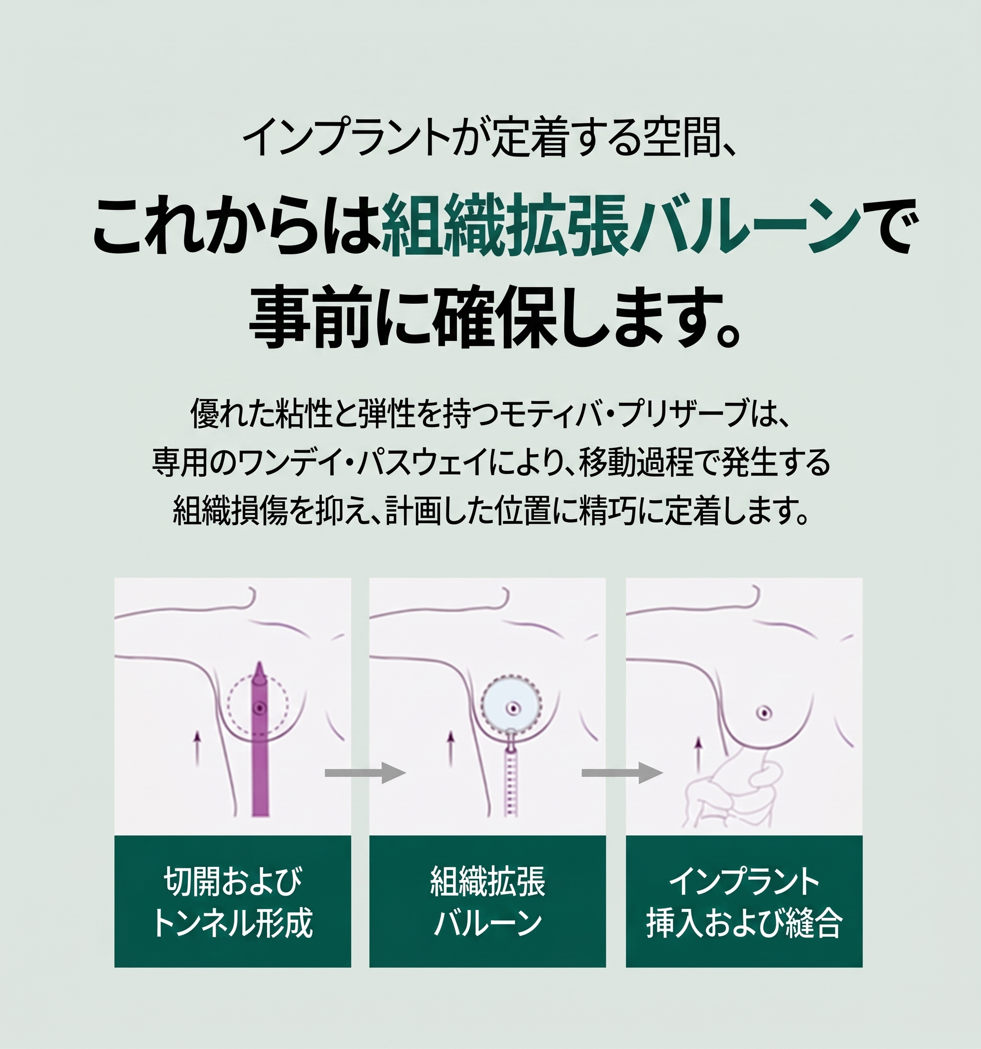 カロスキル整形外科、プリザーブとモティバ豊胸手術は何が違う？ 사진 5