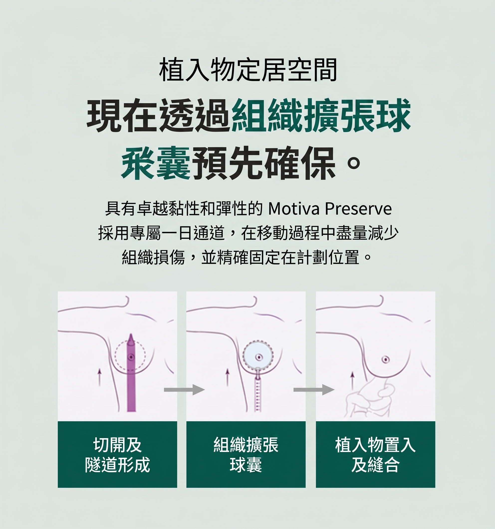 林蔭道整形外科：Preserve 和 Motiva 隆乳手術有何不同？ 사진 5