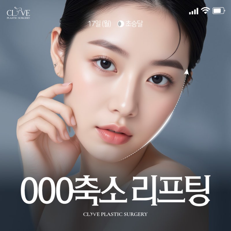 광대실리프팅·입꼬리실리프팅, 중안면리프팅이 필요한 얼굴은?