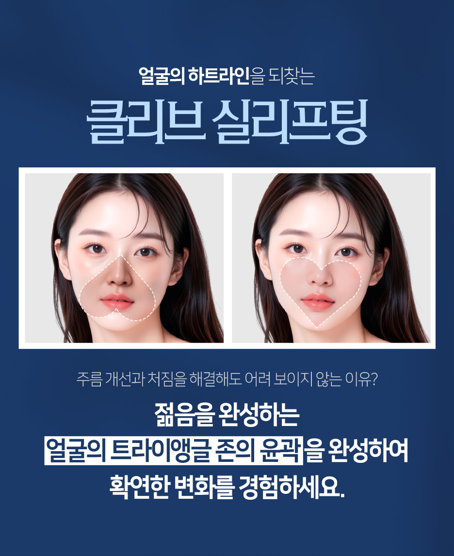 광대실리프팅·입꼬리실리프팅, 중안면리프팅이 필요한 얼굴은? 사진 7