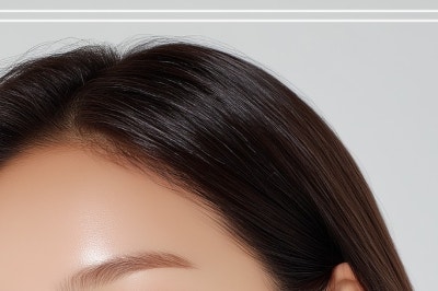 압구정눈재수술 알아본다면? 밑트임재수술과 쌍수절개재수술 전 확인할 것 사진 16