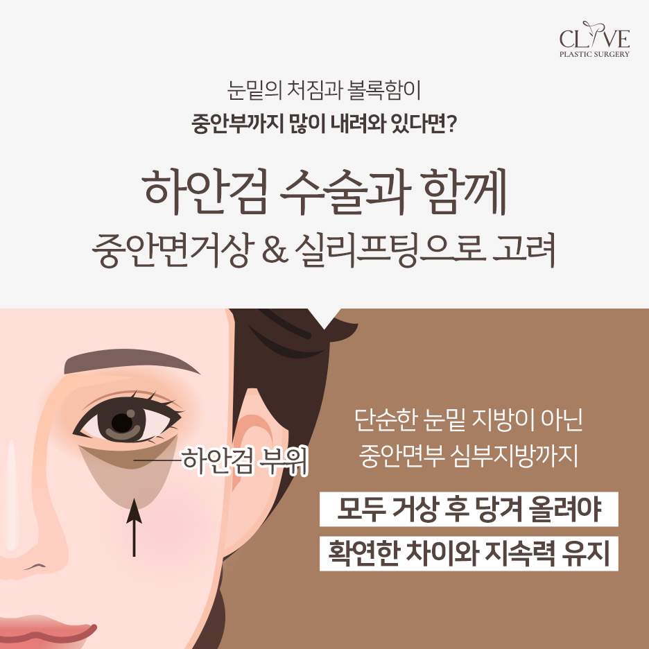 중년 눈성형 고민이라면? 강남하안검수술·중년쌍꺼풀·눈꺼풀처짐수술비용 정리 사진 8