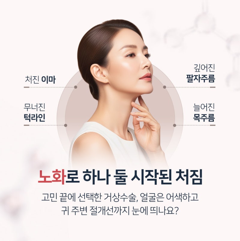 이마거상수술 전후 비교 후 수술하는 이유 (잘하는곳 구분 기준)