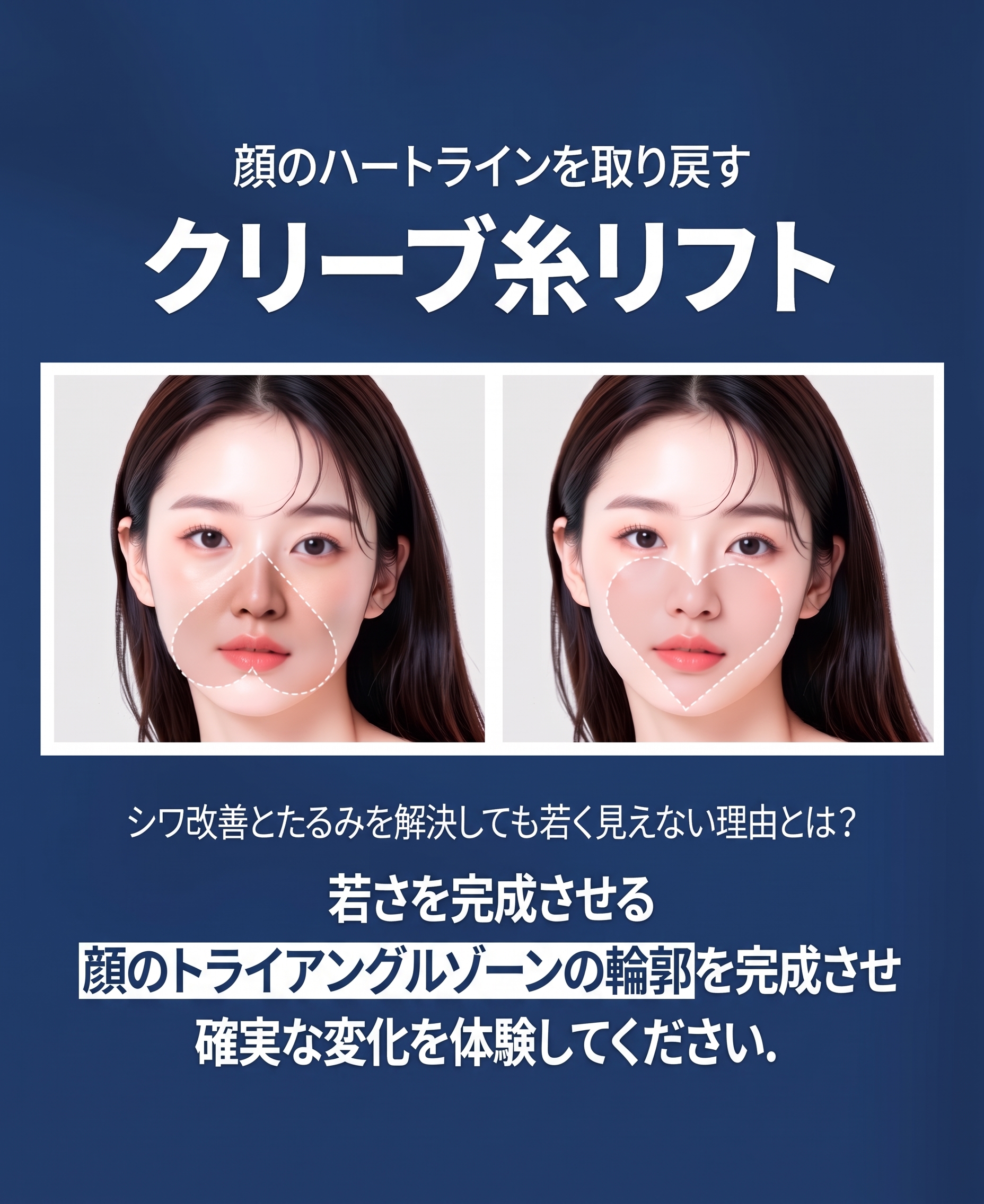 溶ける糸リフト、二重顎の糸リフトも自分に合わせて？クリニック選びに迷ったら 사진 7