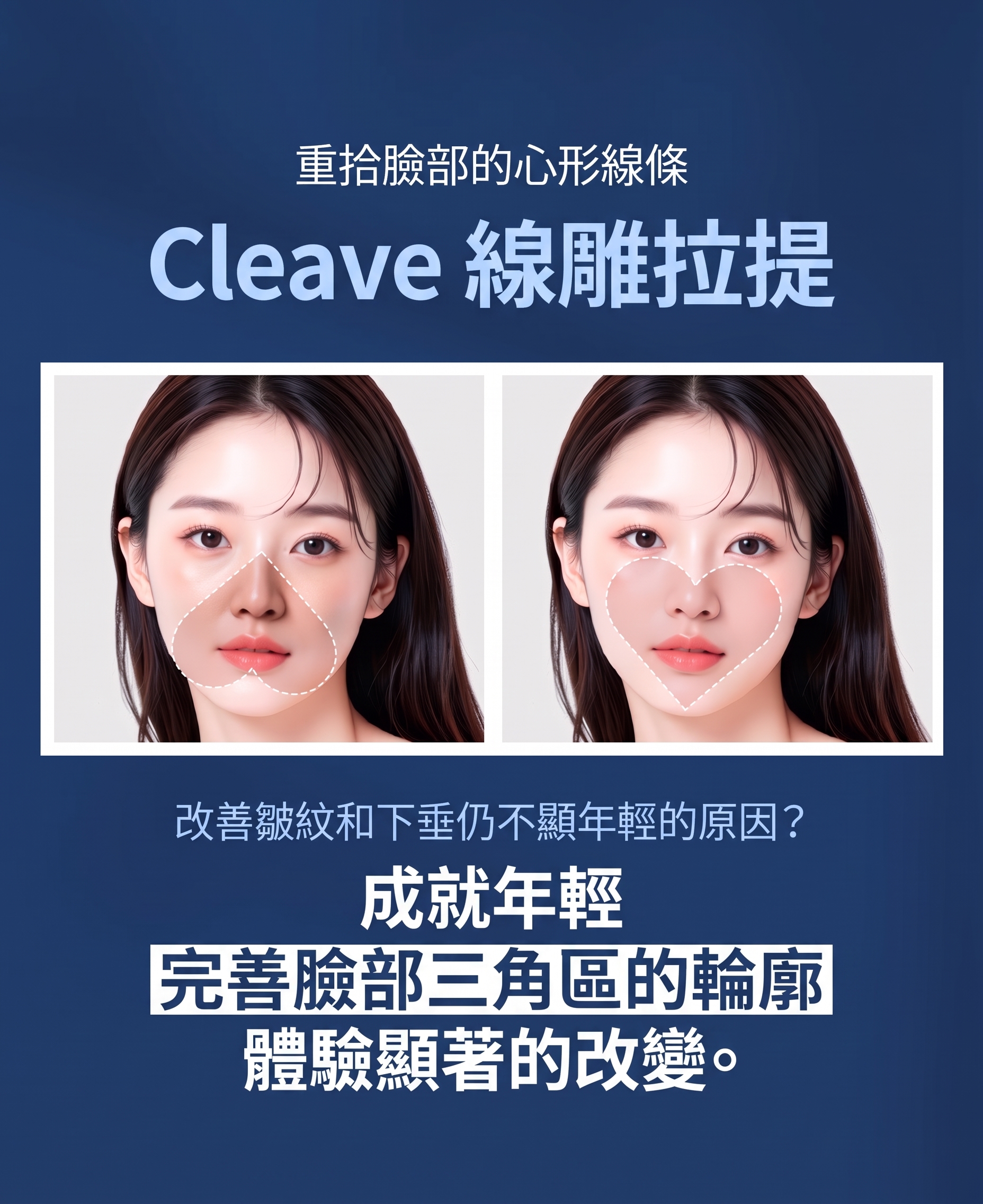 可吸收線雕、雙下巴埋線也能客製化?如果您正在苦惱該選擇哪家診所 사진 7