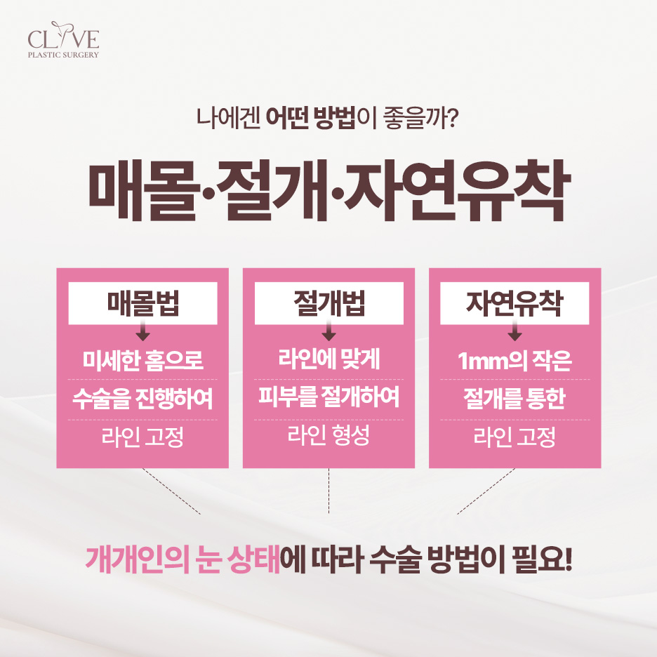역삼동성형외과, 쌍수 라인만 보고 골라도 될까? 눈매교정 수술 방법까지
