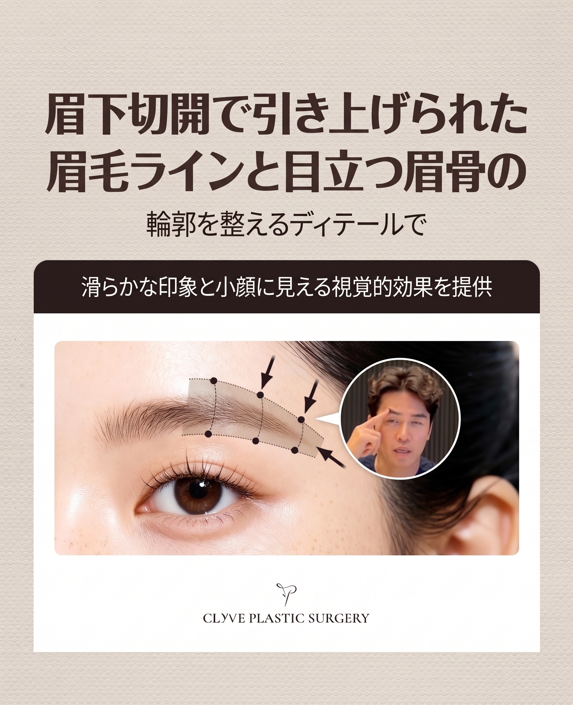眉下切開・眉下リフト、「引き上げる」だけで十分でしょうか？ 사진 9