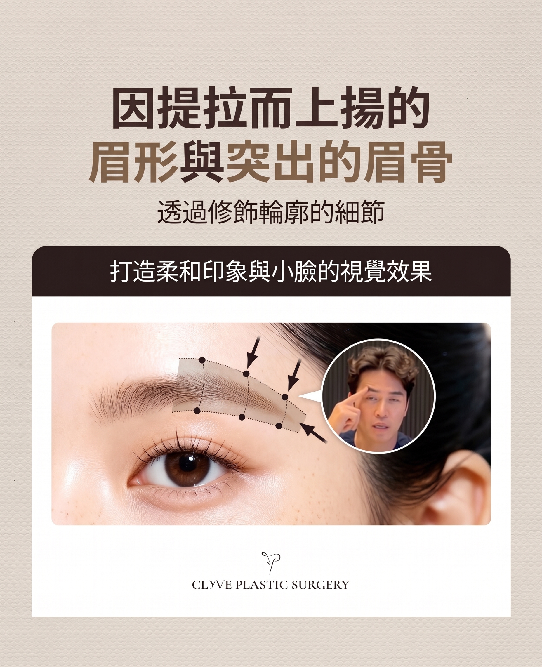 提眉術、眉下切口拉皮，只靠「往上拉」就足夠了嗎？ 사진 9