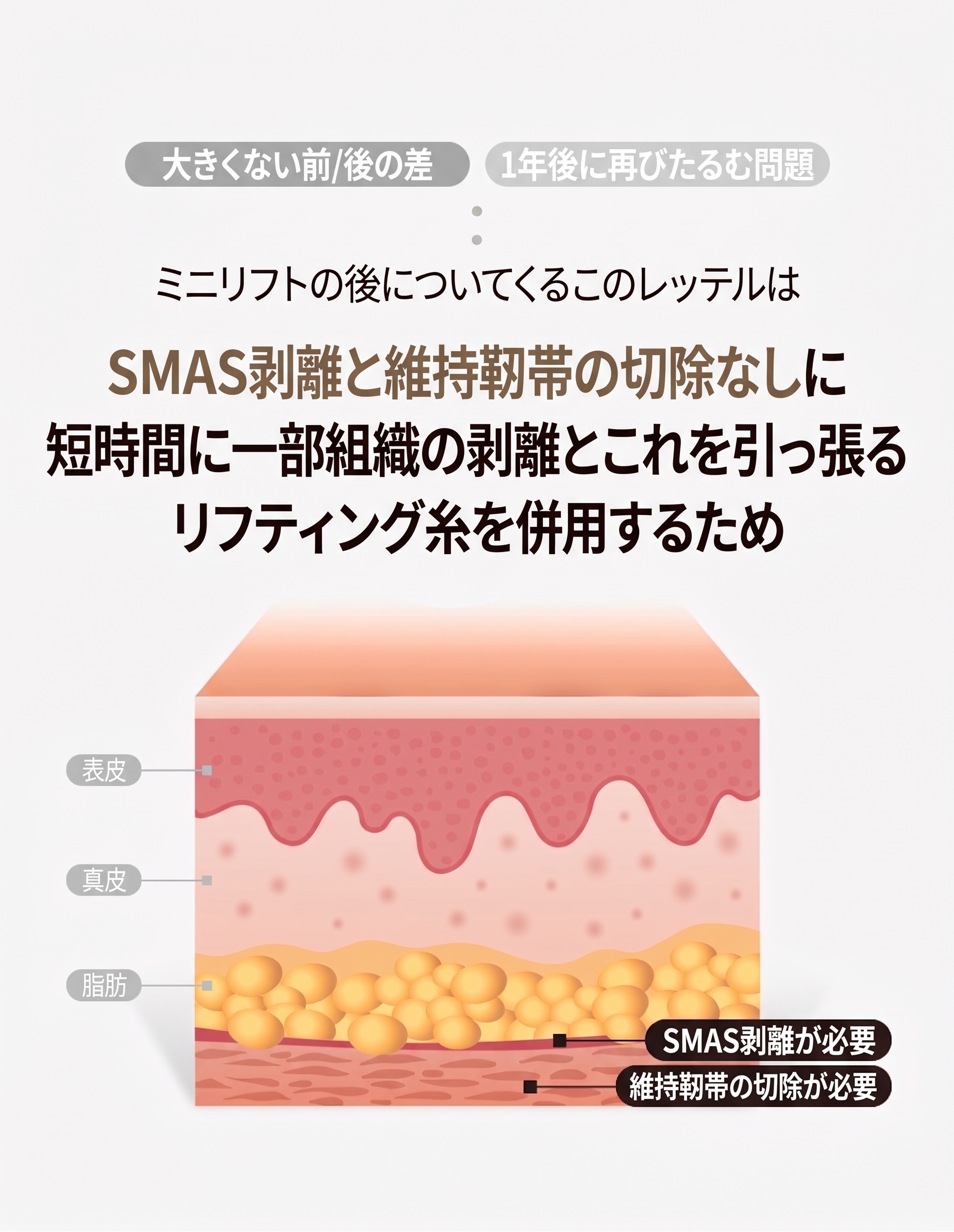 眉下切開・眉下リフト、「引き上げる」だけで十分でしょうか？ 사진 5