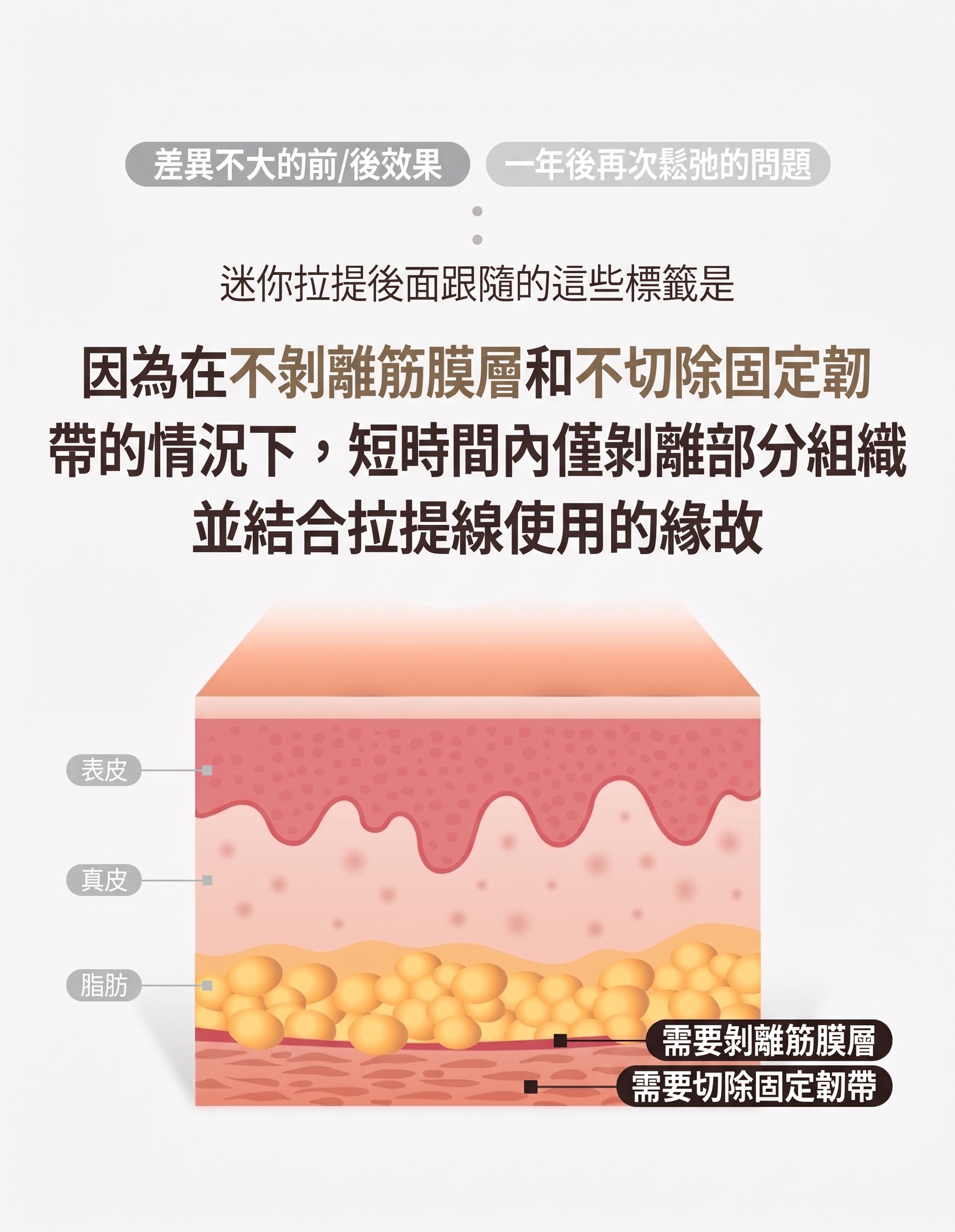 提眉術、眉下切口拉皮，只靠「往上拉」就足夠了嗎？ 사진 5