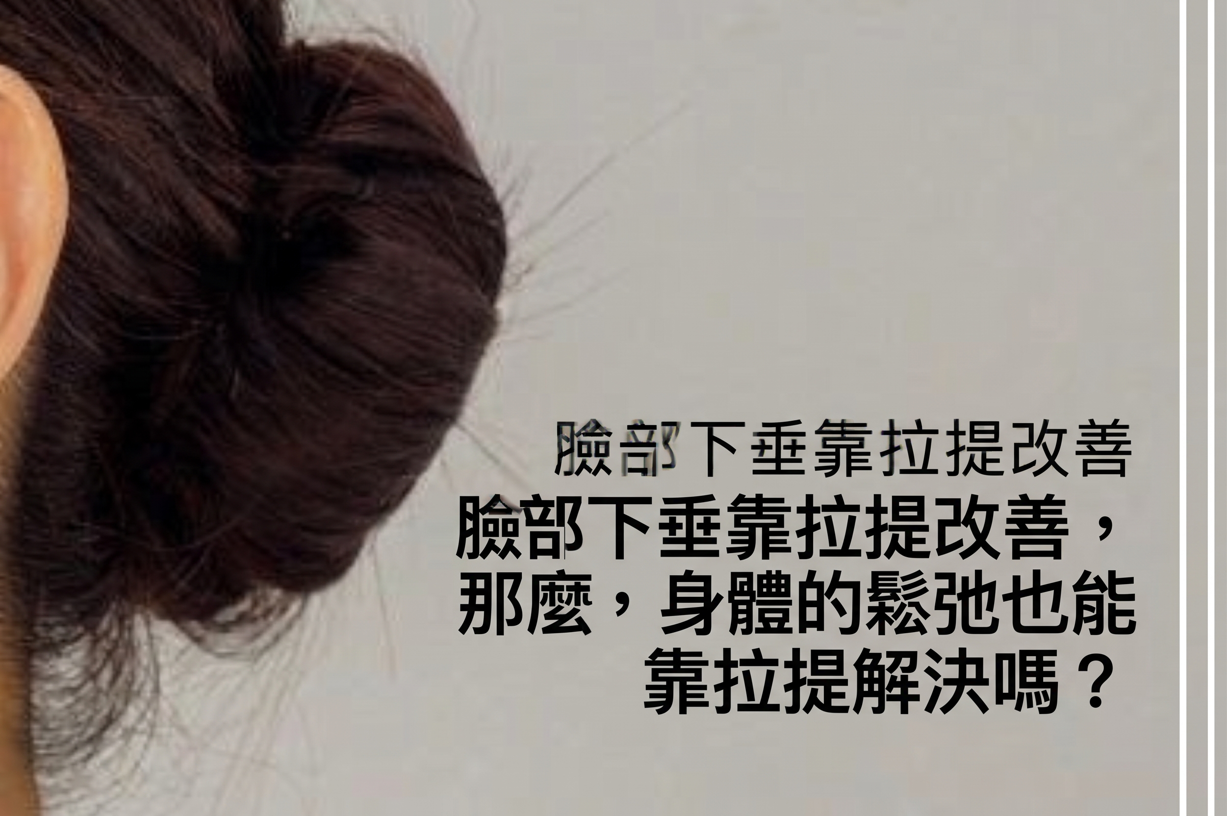 提眉術、眉下切口拉皮，只靠「往上拉」就足夠了嗎？ 사진 22