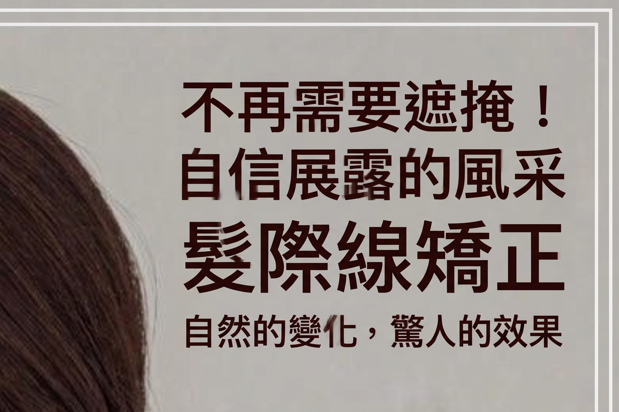 提眉術、眉下切口拉皮，只靠「往上拉」就足夠了嗎？ 사진 19