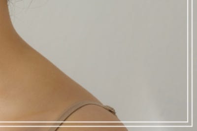 눈썹밑올림술, 눈썹밑거상 ‘올리는 것’만으로 충분할까요? 사진 25