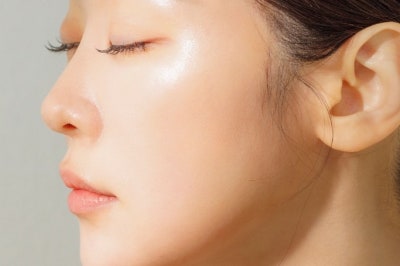 눈썹밑올림술, 눈썹밑거상 ‘올리는 것’만으로 충분할까요? 사진 21