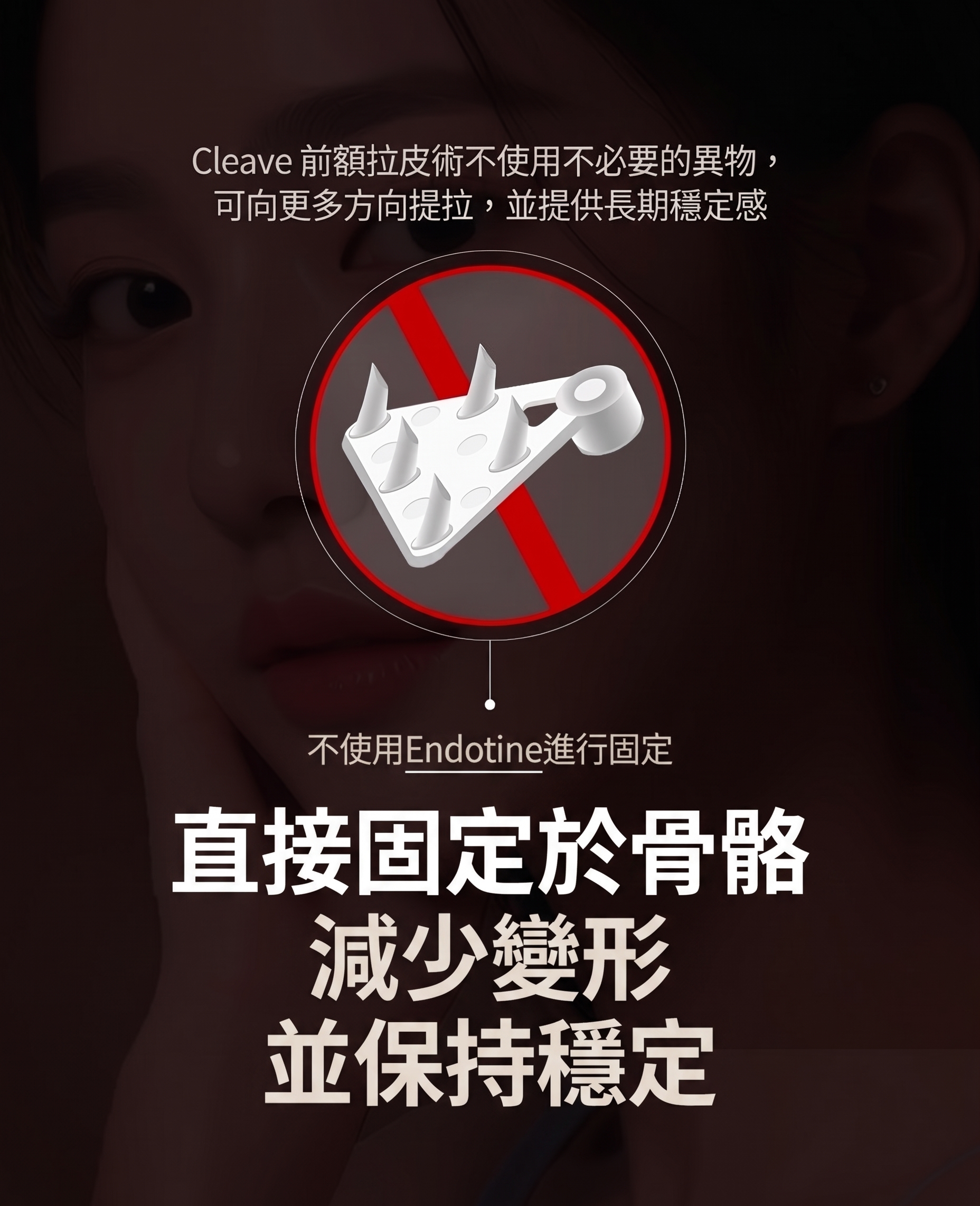 提眉術、眉下切口拉皮，只靠「往上拉」就足夠了嗎？ 사진 8