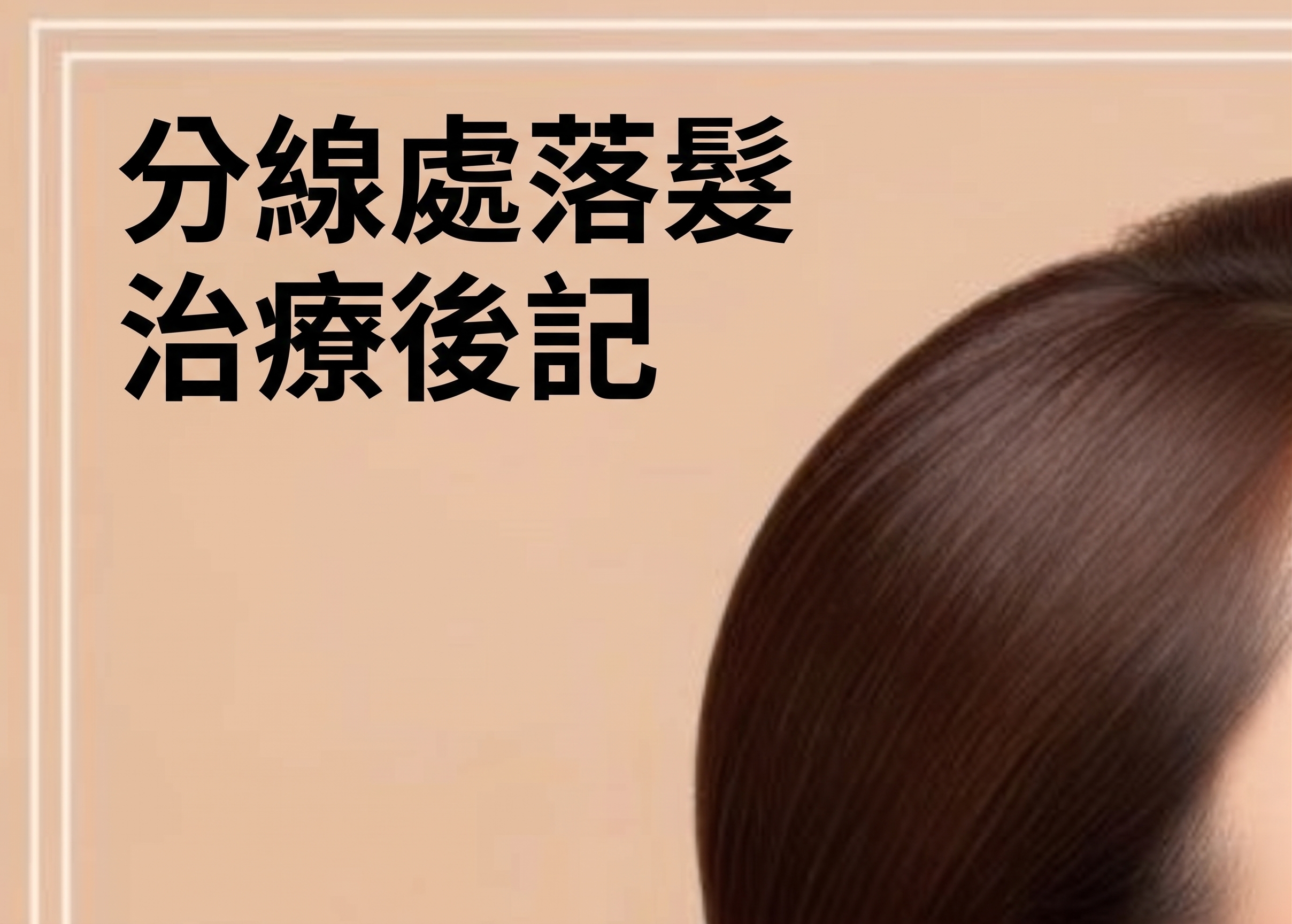 中年眼部手術，為眼皮下垂而煩惱？眼瞼下垂手術前必須了解的要點（中年雙眼皮） 사진 16
