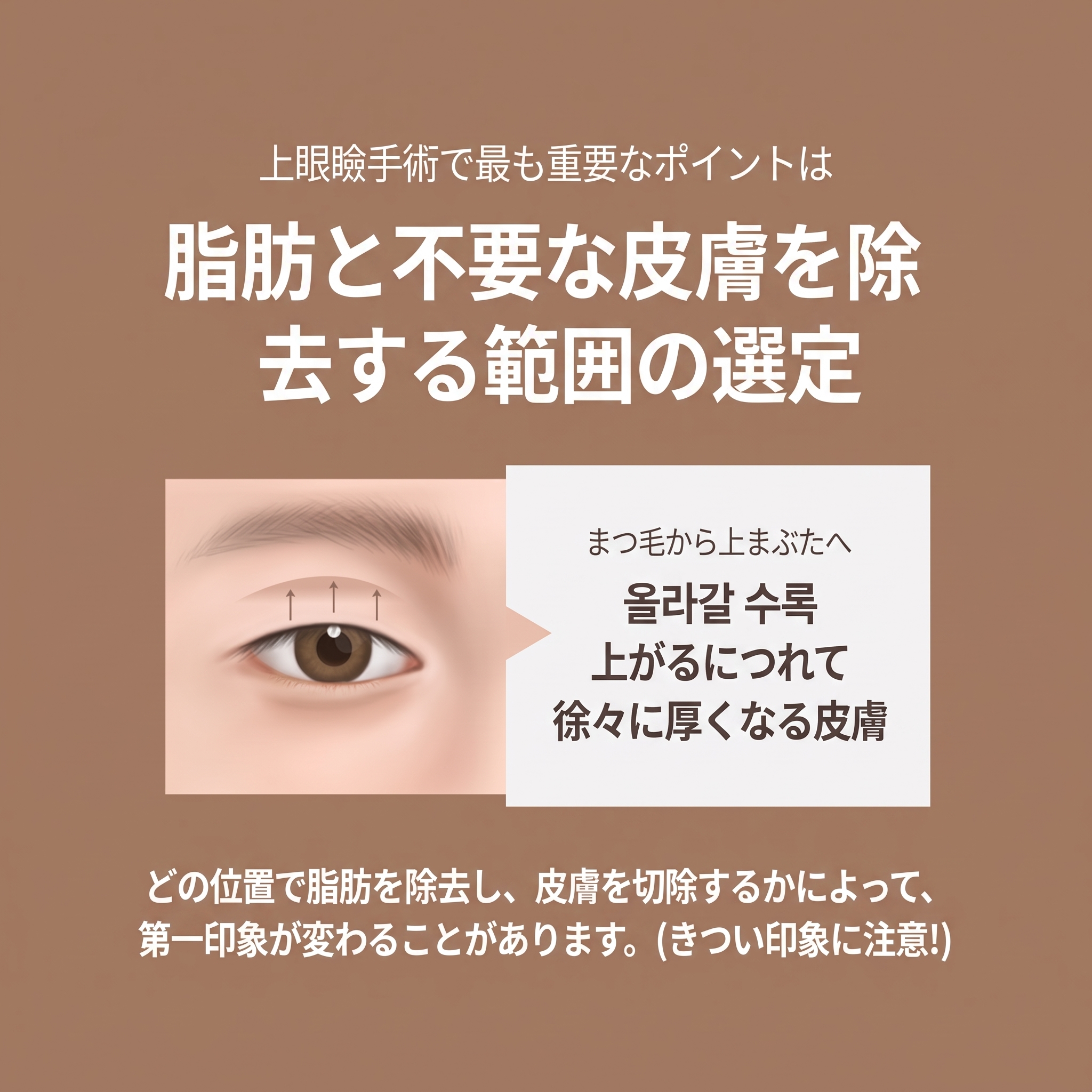 中年の目元整形、まぶたのたるみが気になったら？たるみ取り手術の前に知っておきたいこと（ミドル世代の二重整形） 사진 4