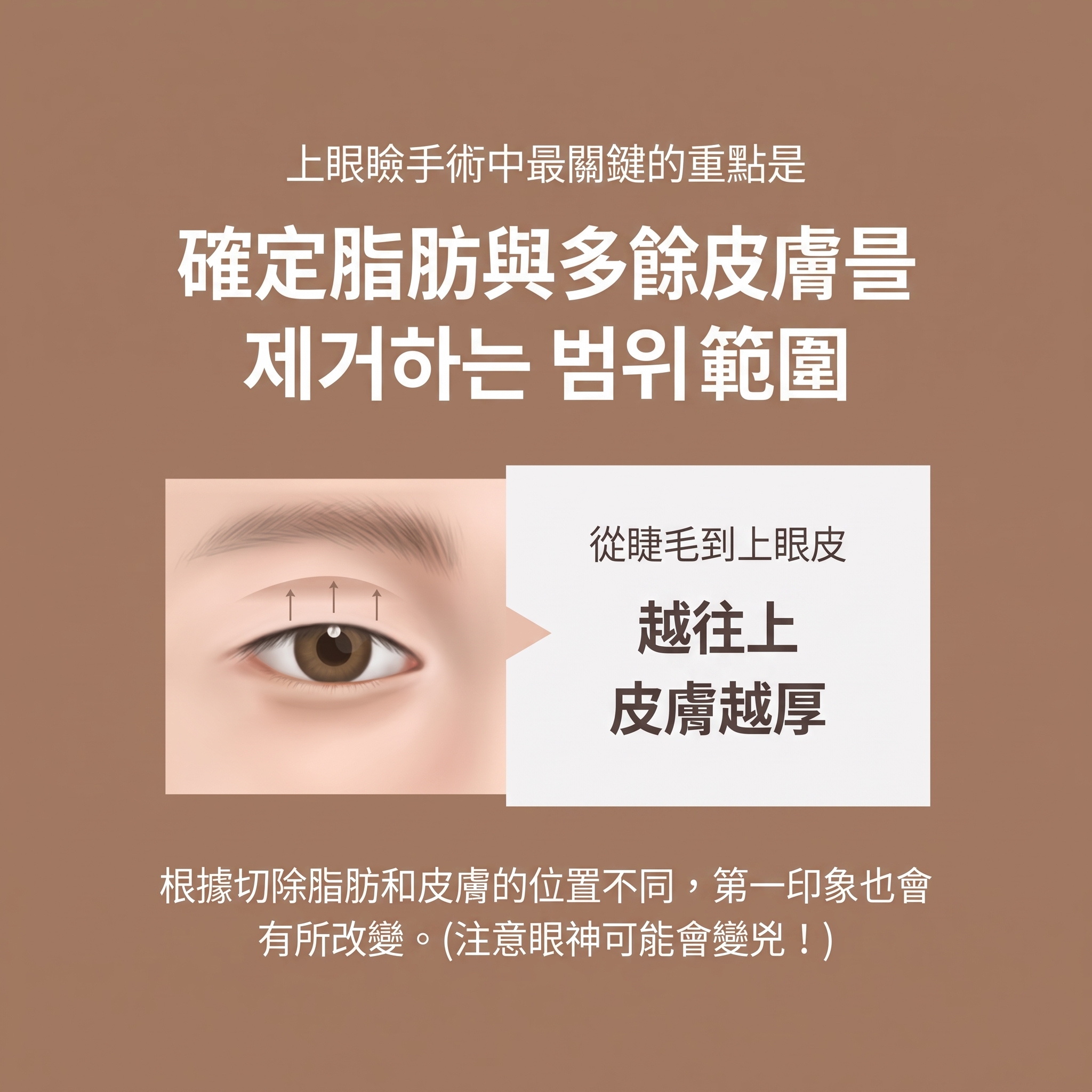 中年眼部手術，為眼皮下垂而煩惱？眼瞼下垂手術前必須了解的要點（中年雙眼皮） 사진 4
