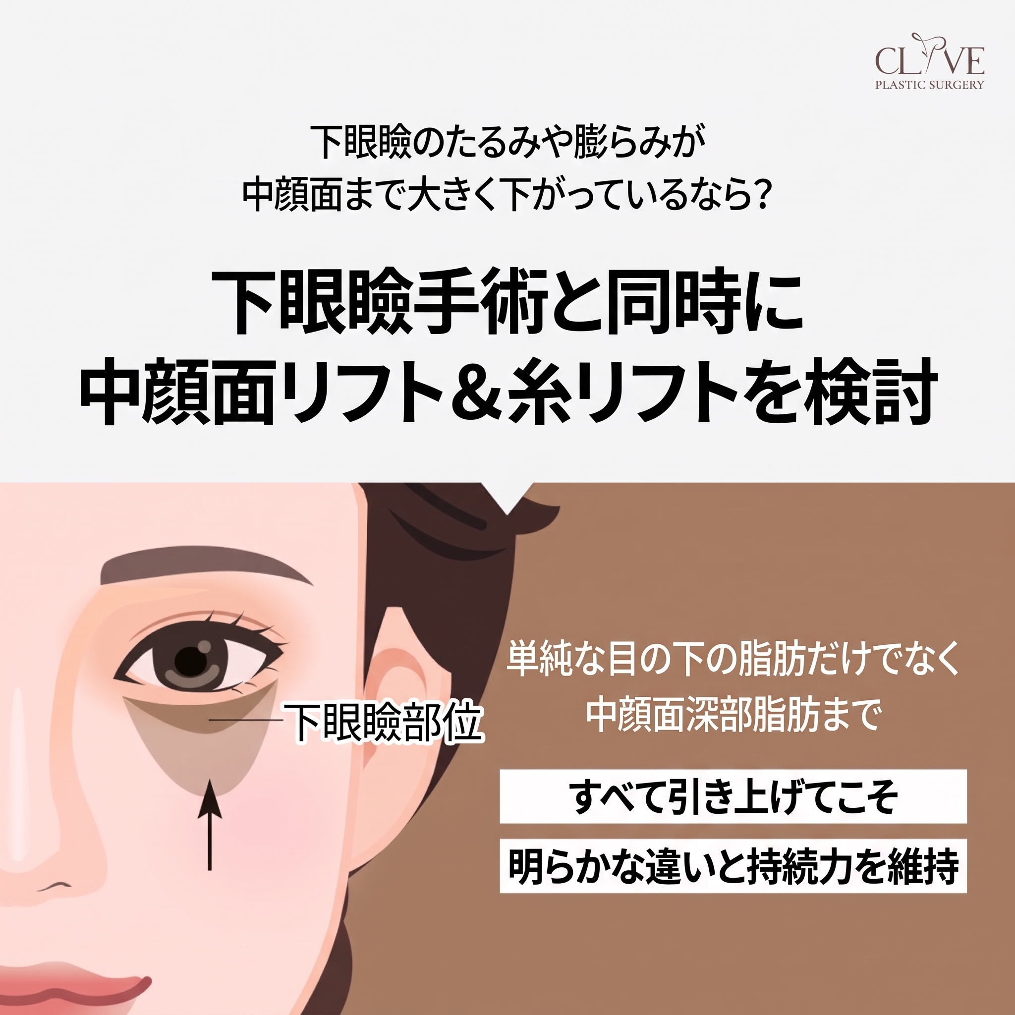 中年の目元整形、まぶたのたるみが気になったら？たるみ取り手術の前に知っておきたいこと（ミドル世代の二重整形） 사진 8