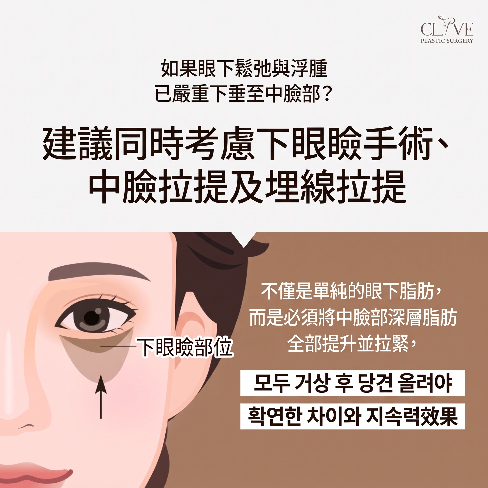 中年眼部手術，為眼皮下垂而煩惱？眼瞼下垂手術前必須了解的要點（中年雙眼皮） 사진 8