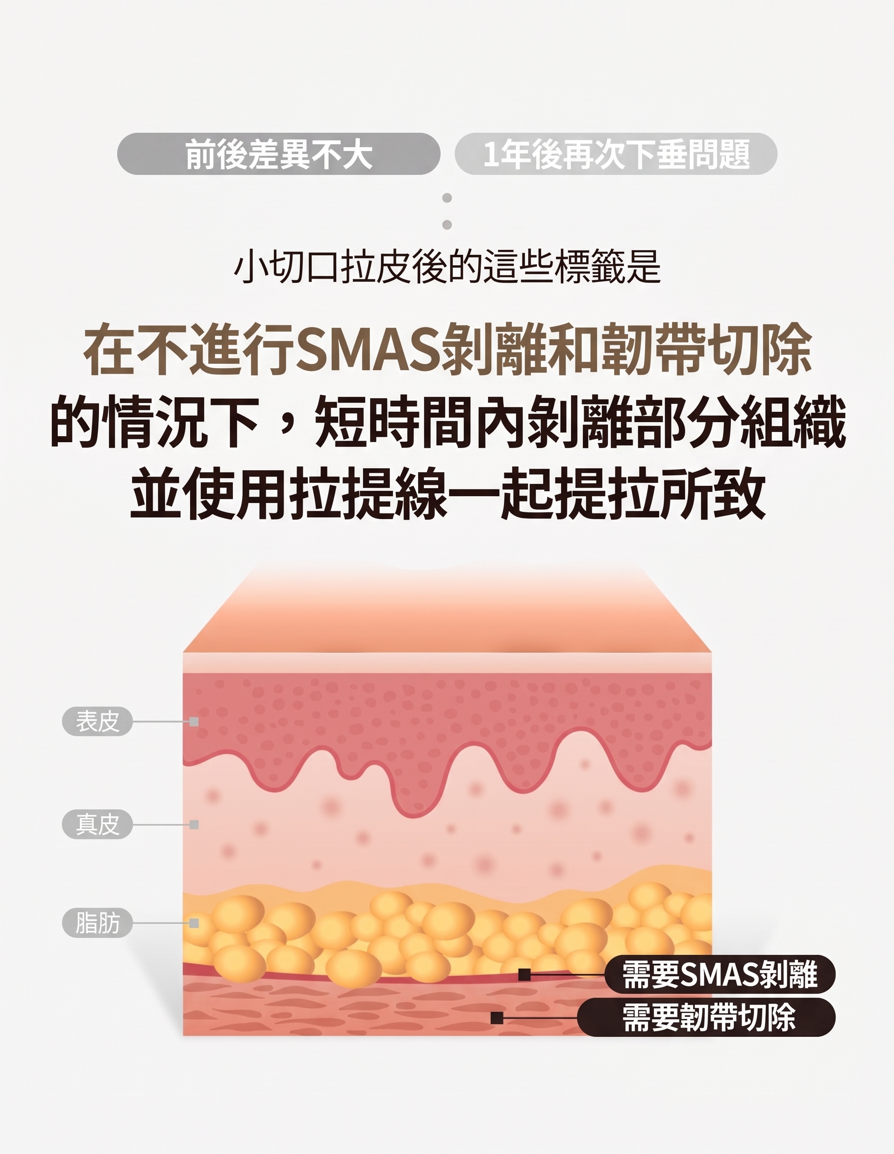 額頭拉皮手術，只要拉額頭就夠了嗎？若連迷你臉部拉皮一起考慮，費用該如何衡量？ 사진 5