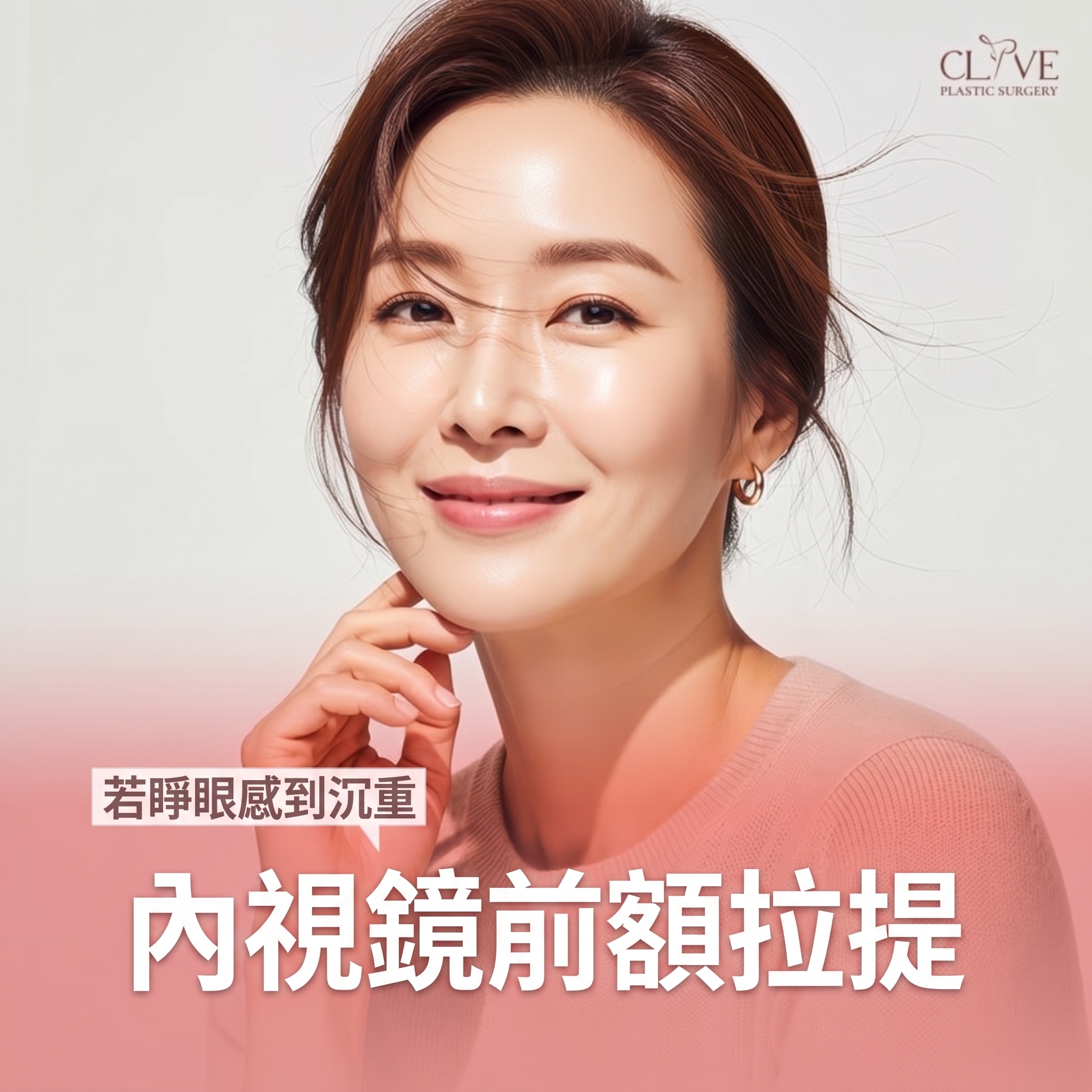 額頭拉皮手術，只要拉額頭就夠了嗎？若連迷你臉部拉皮一起考慮，費用該如何衡量？