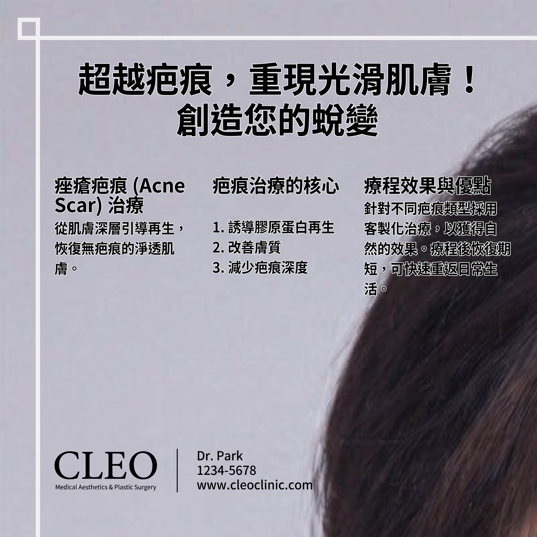 上下眼瞼手術，只看眼皮就夠了嗎？從眉毛到眼袋下垂全面解析（上眼瞼下眼瞼手術） 사진 16