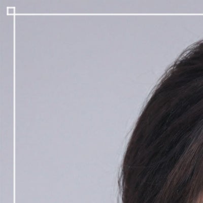 상하안검수술, 눈꺼풀만 보면 될까? 눈썹부터 눈밑쳐짐까지 (상안검하안검수술) 사진 16