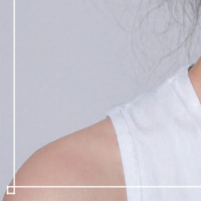 상하안검수술, 눈꺼풀만 보면 될까? 눈썹부터 눈밑쳐짐까지 (상안검하안검수술) 사진 22