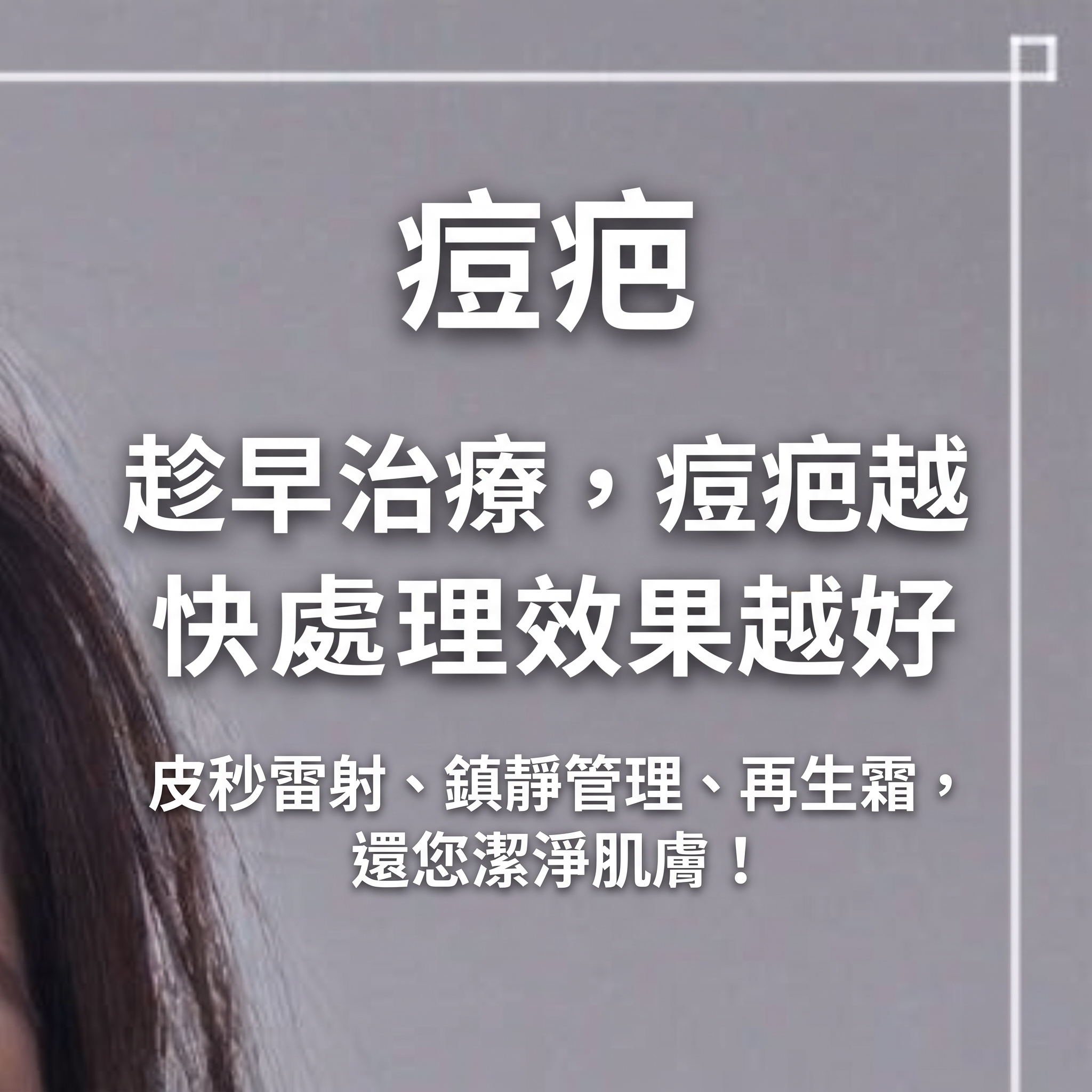 上下眼瞼手術，只看眼皮就夠了嗎？從眉毛到眼袋下垂全面解析（上眼瞼下眼瞼手術） 사진 18