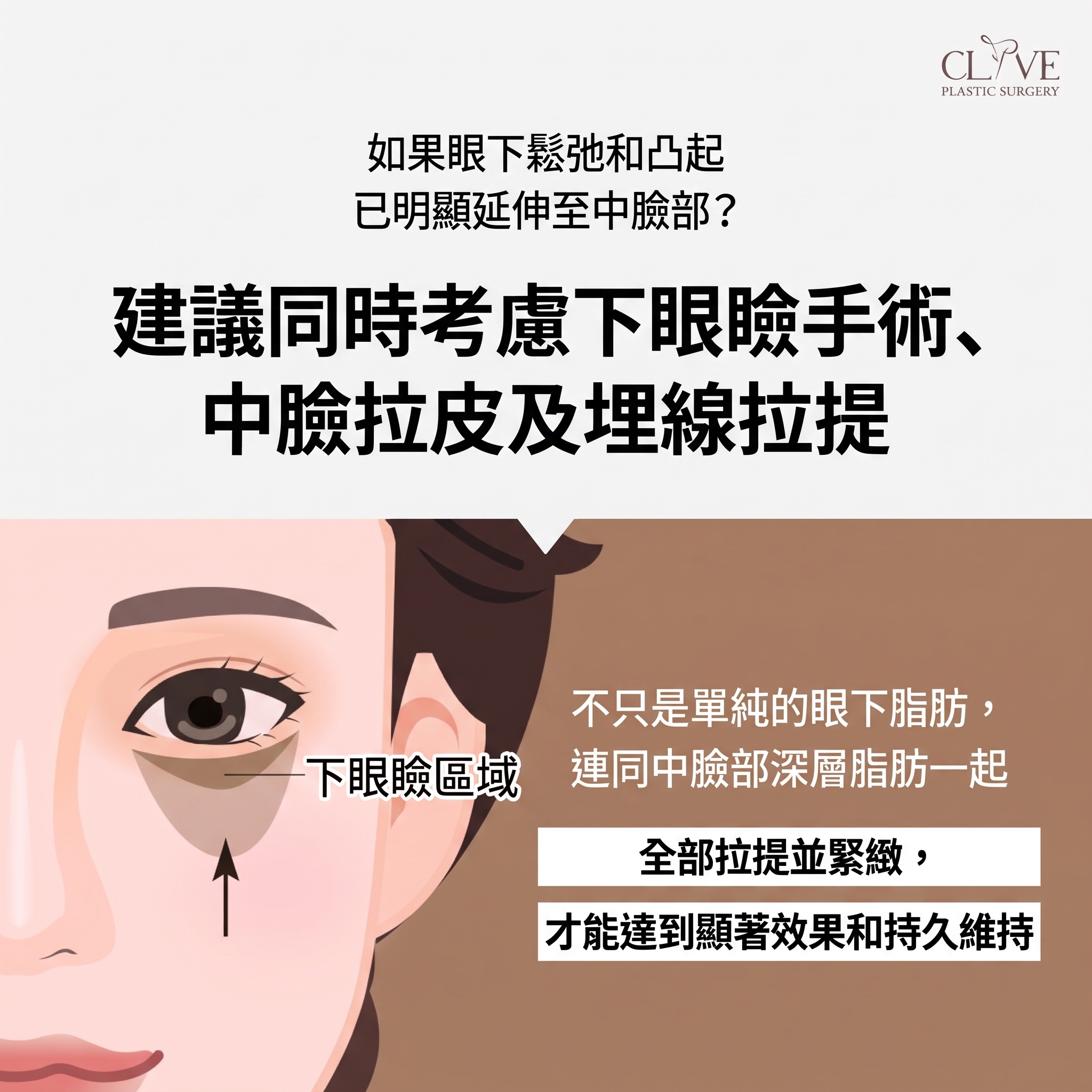 上下眼瞼手術，只看眼皮就夠了嗎？從眉毛到眼袋下垂全面解析（上眼瞼下眼瞼手術） 사진 8
