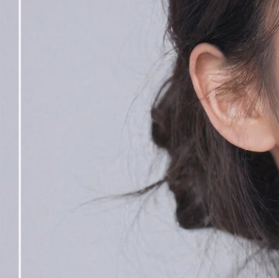 상하안검수술, 눈꺼풀만 보면 될까? 눈썹부터 눈밑쳐짐까지 (상안검하안검수술) 사진 19