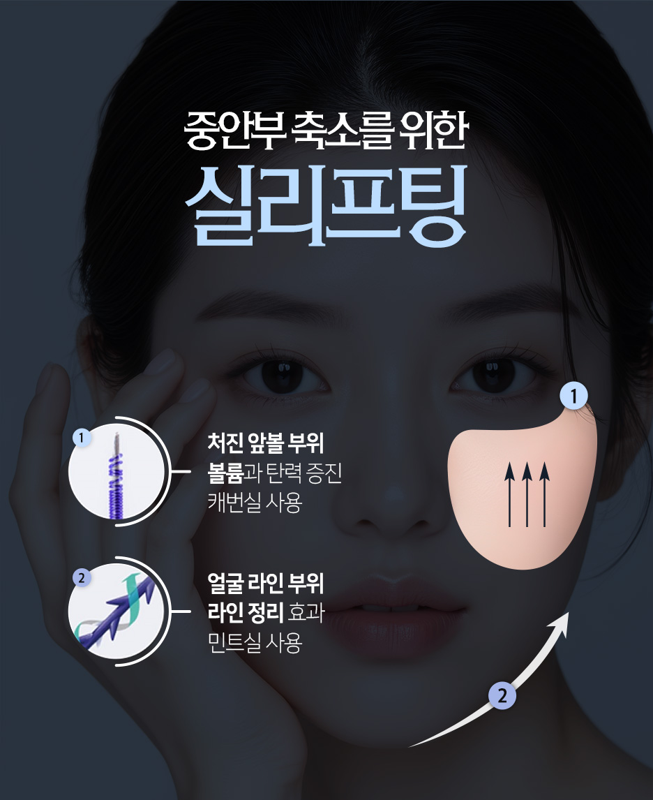 실리프팅시술, 팔자만 당기면 끝일까? 병원 찾기 전 추천 포인트 사진 4