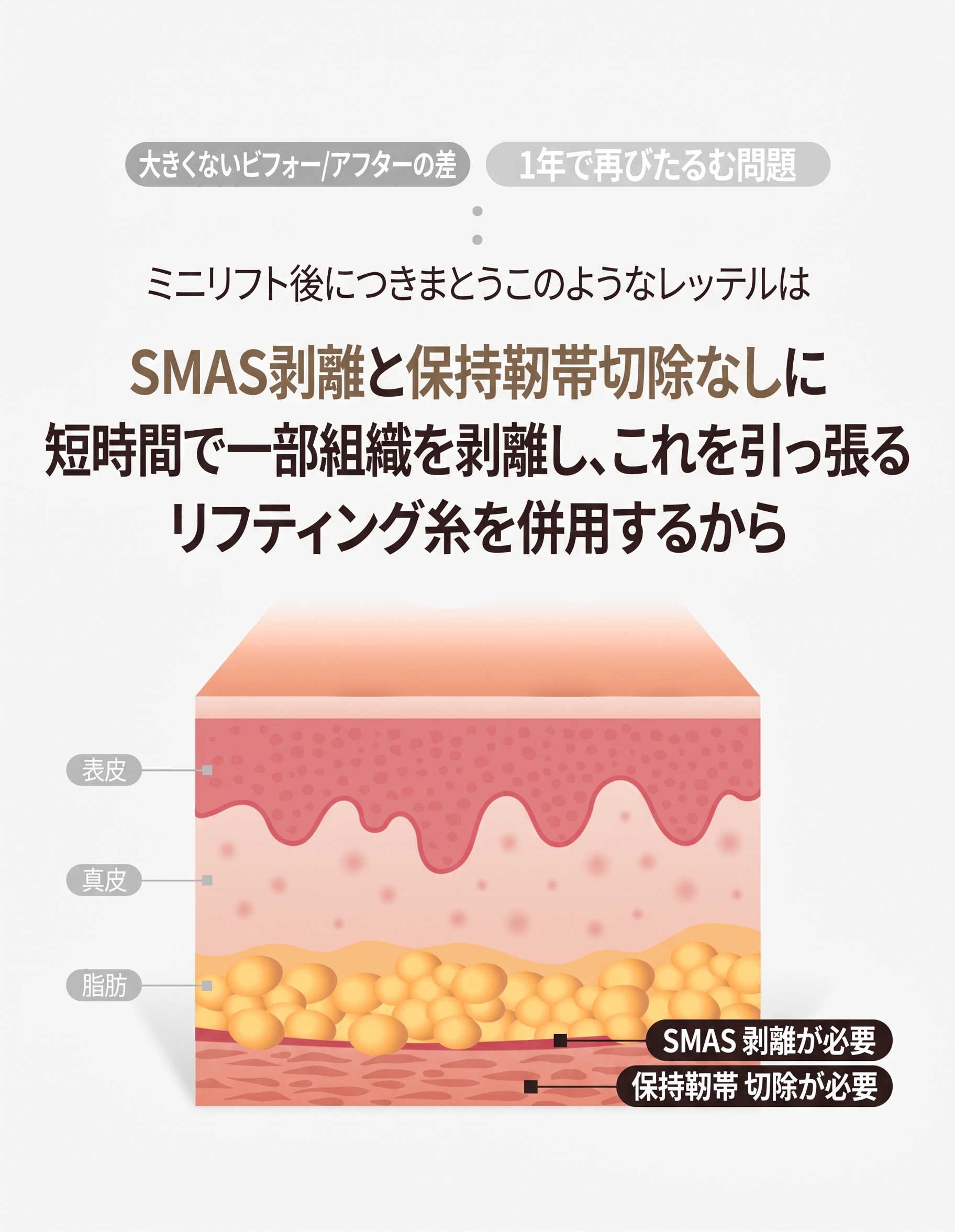眉下切開(眉下リフト)を検討する際、切除範囲を最初に見極めるべき理由 사진 5