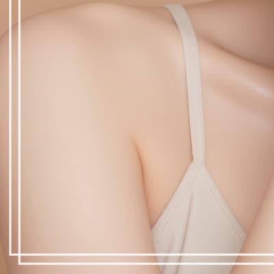 미니안면거상, ‘여기’만 당기면 될까? 이마성형 눈썹하거상까지 사진 25
