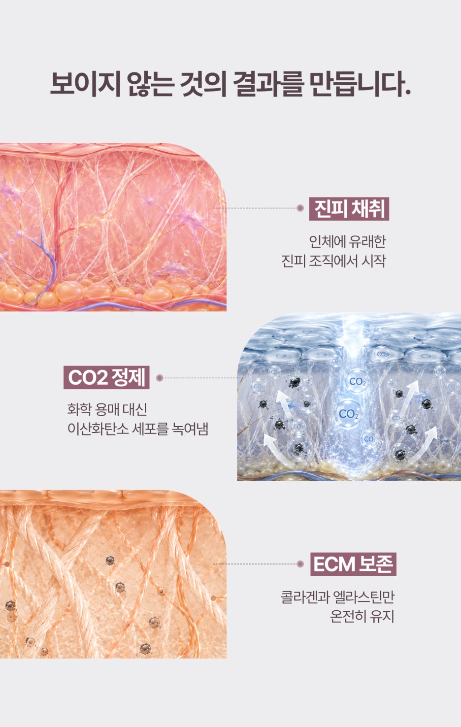 스킨부스터효과, 리투오·주브아셀 뭐가 다를까? 청담성형외과 알아본다면 사진 7