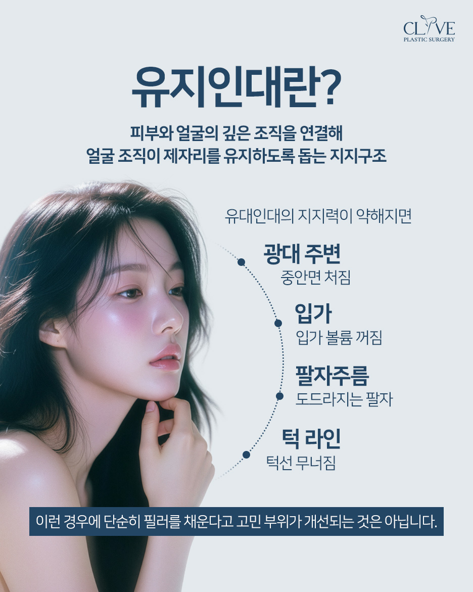유지인대필러, 꺼진 곳만 채우던 필러에서 벗어나기 (리프팅필러) 사진 2