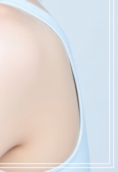 유지인대필러, 꺼진 곳만 채우던 필러에서 벗어나기 (리프팅필러) 사진 20