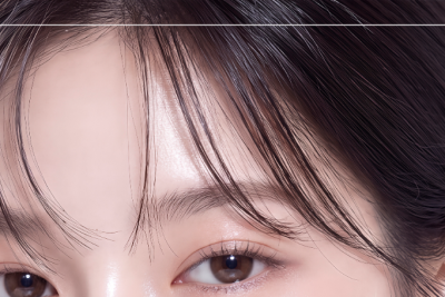 얼굴실리프팅, 내 얼굴에 맞는 실리프팅종류｜페이스리프팅 알아보기 사진 18