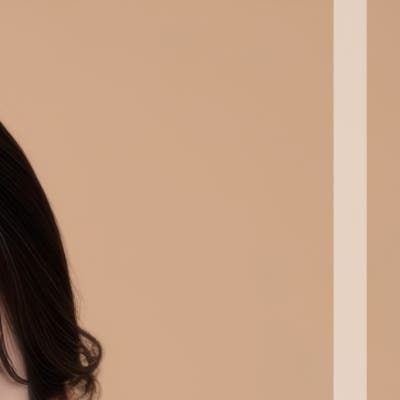 흉터제거수술, 패임과 솟아오른 자국엔 줄기세포치료가 답일까? (논현성형외과) 사진 14